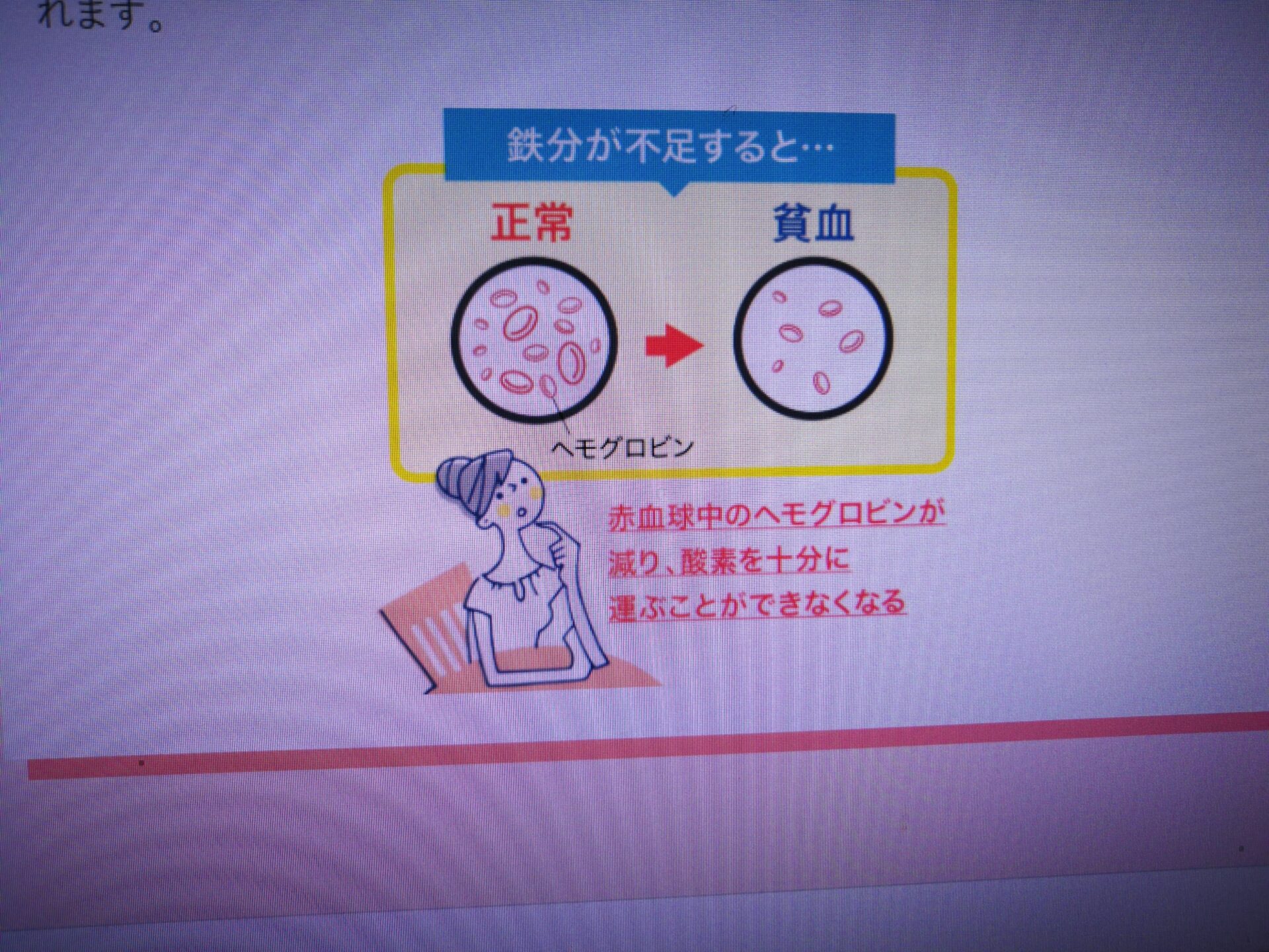 貧血